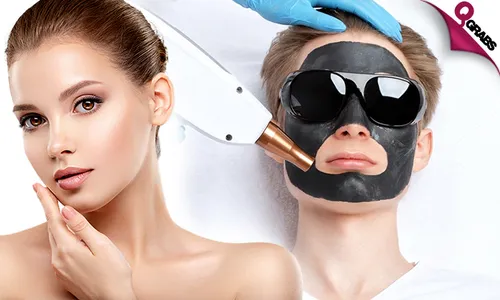 Carbon Laser Peel Treatments!